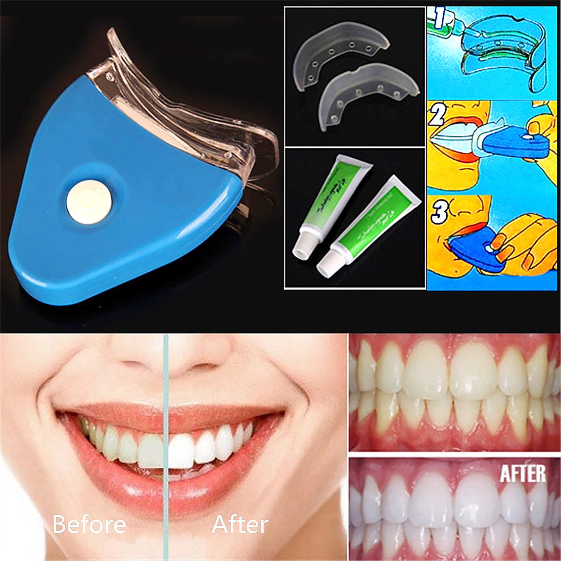 Oral Gel Teeth Tooth Whitening Whitener Dental Bleaching LED Empower Wellness Fitness